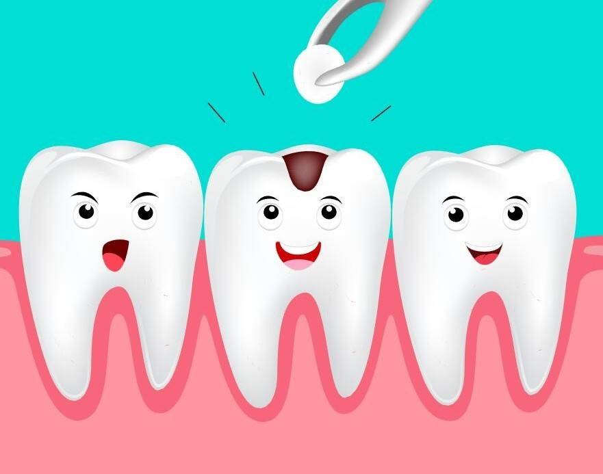 补的牙齿能用多久(补牙需要多少天全部完成) 第3张