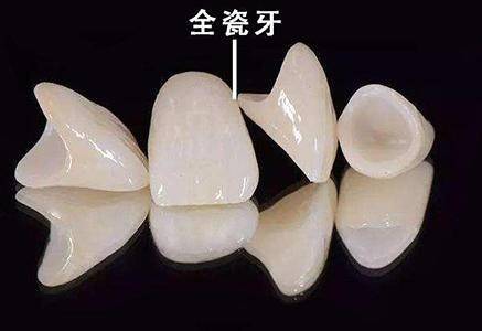 补的牙齿能用多久(补牙需要多少天全部完成) 第6张